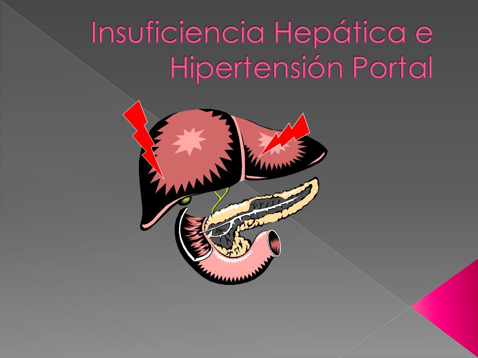 Enfermedad hepática e hipertensión Enfermedad hepática e hipertensión